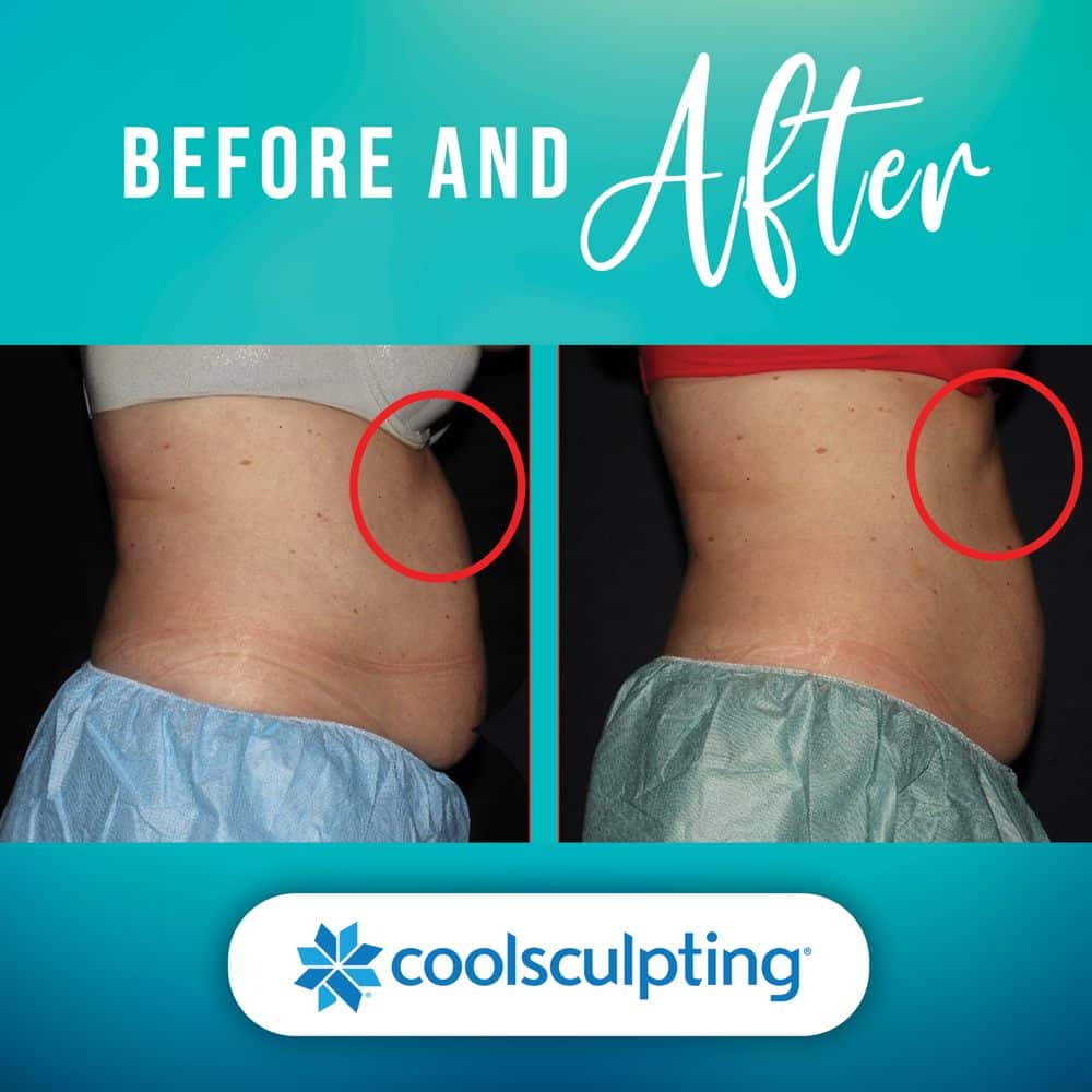 Best Weight Loss Clinic Center Broken Arrow Oklahoma Best Weight Loss Clinic Center Broken Arrow Oklahoma