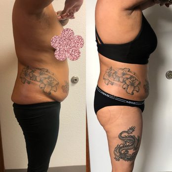 Best Weight Loss Clinic Center Greeley Colorado