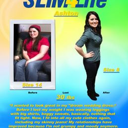 Best Weight Loss Clinic Center Olathe Kansas