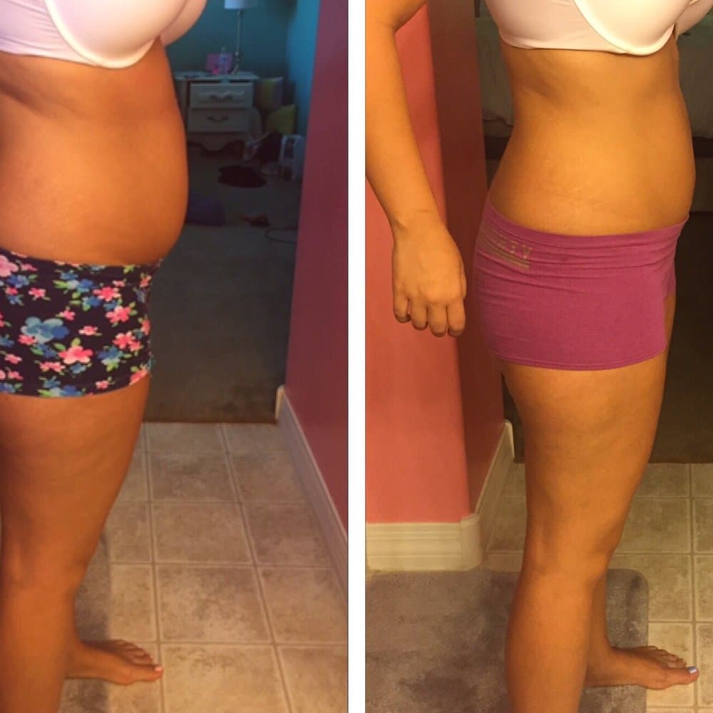 Best Weight Loss Clinic Center Peoria Arizona Best Weight Loss Clinic Center Peoria Arizona