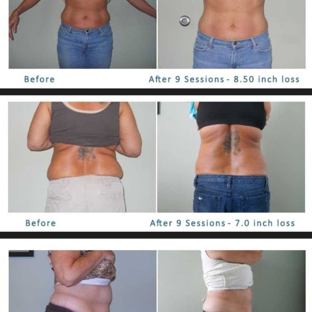 Best Weight Loss Clinic Center Santa Barbara California
