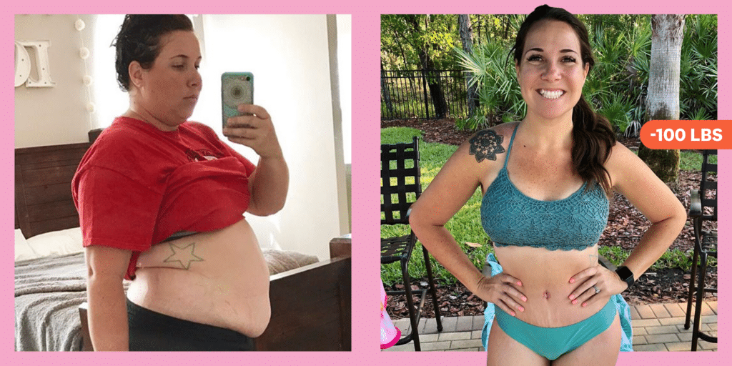 How To Lose Weight With PCOS