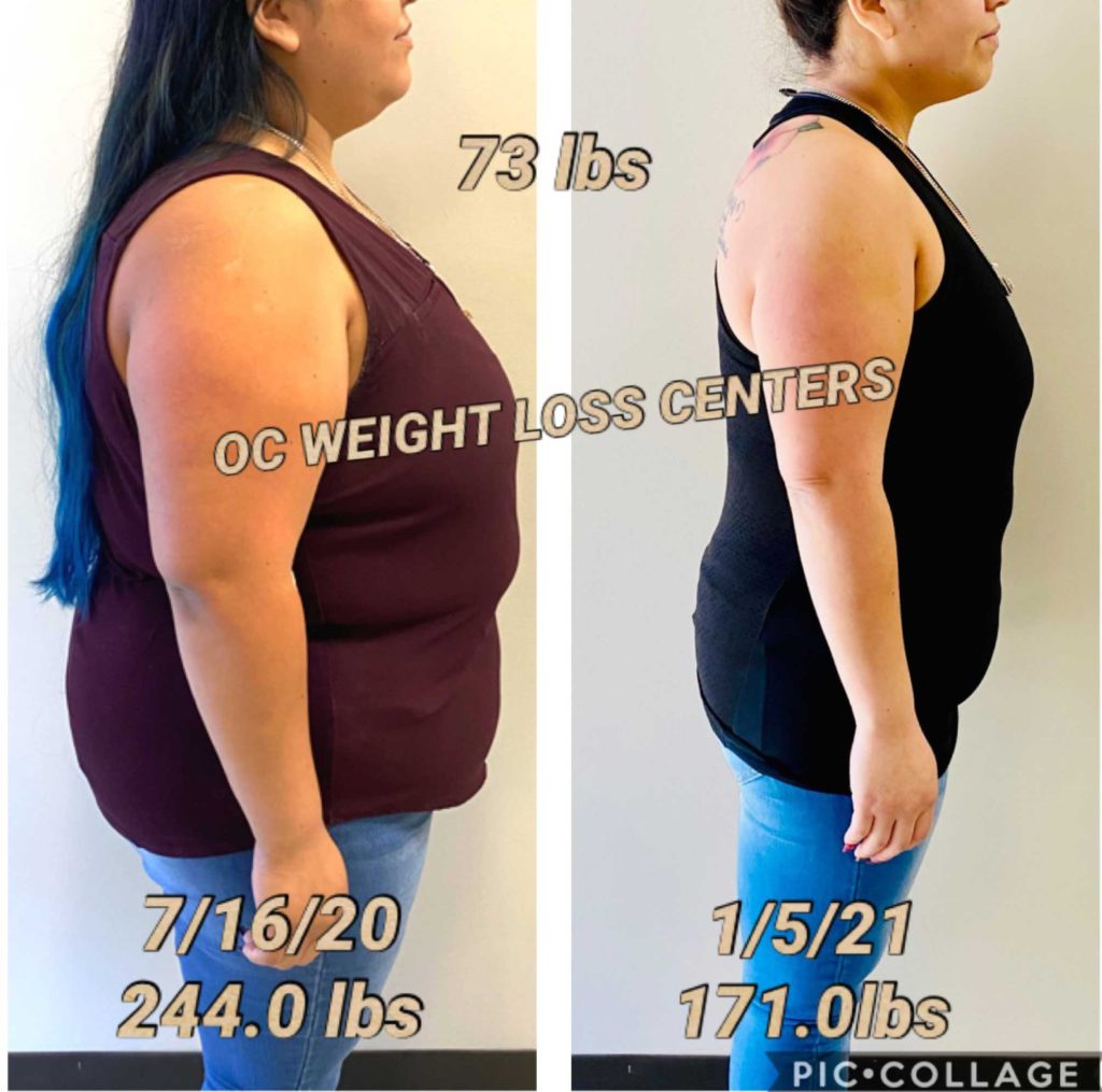 30 Day Phentermine Results Before And After 30 Day Phentermine Results Before And After