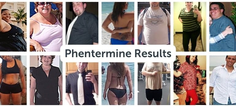 30 Day Phentermine Results Before And After 30 Day Phentermine Results Before And After