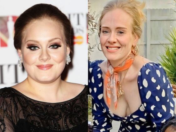 Adele Gastric Sleeve