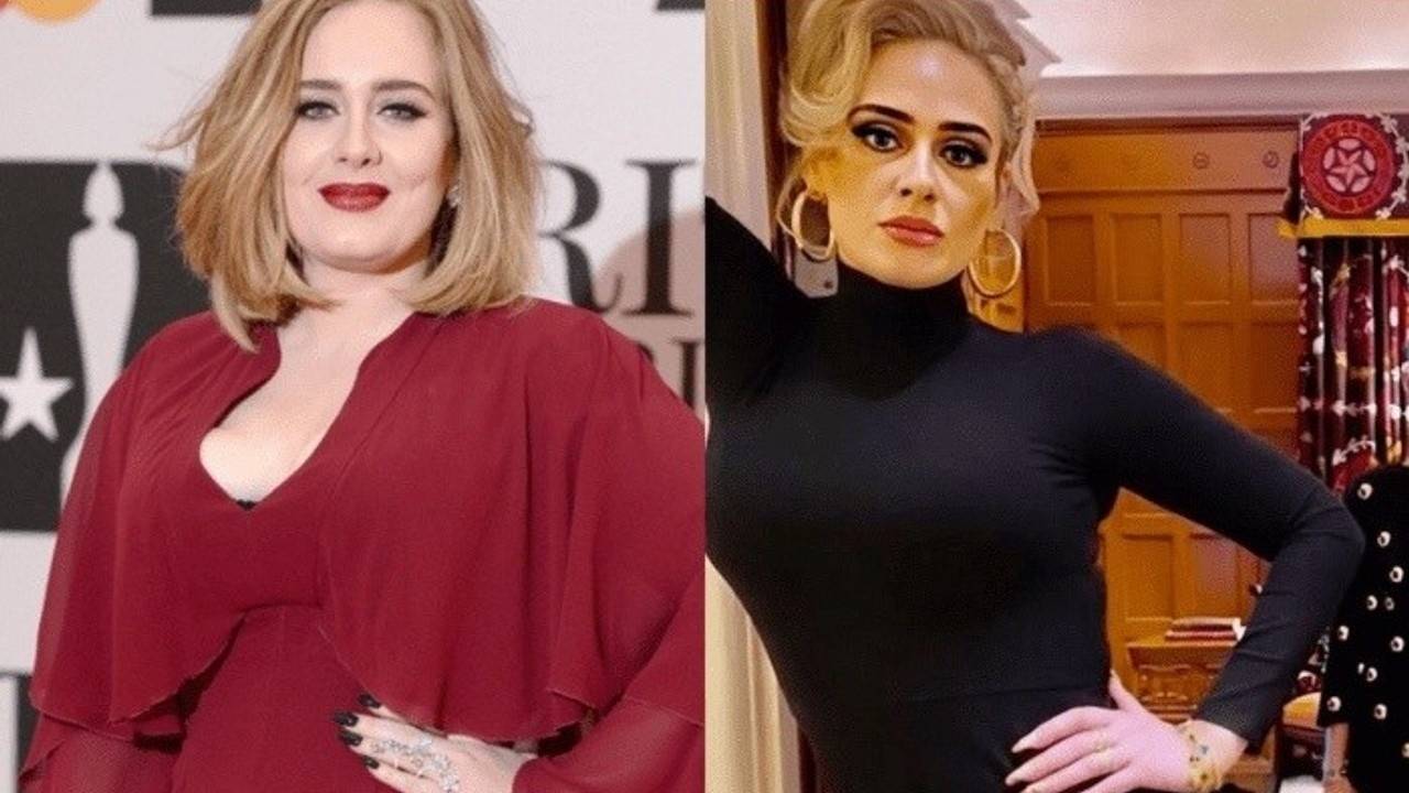 Adele Gastric Sleeve