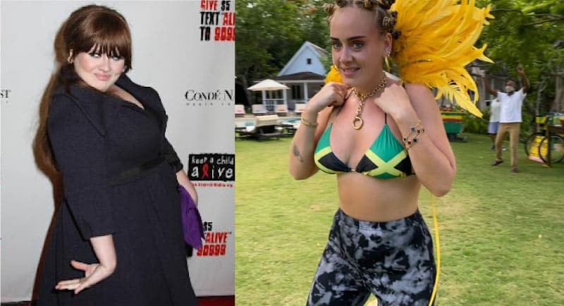 Adele Gastric Sleeve