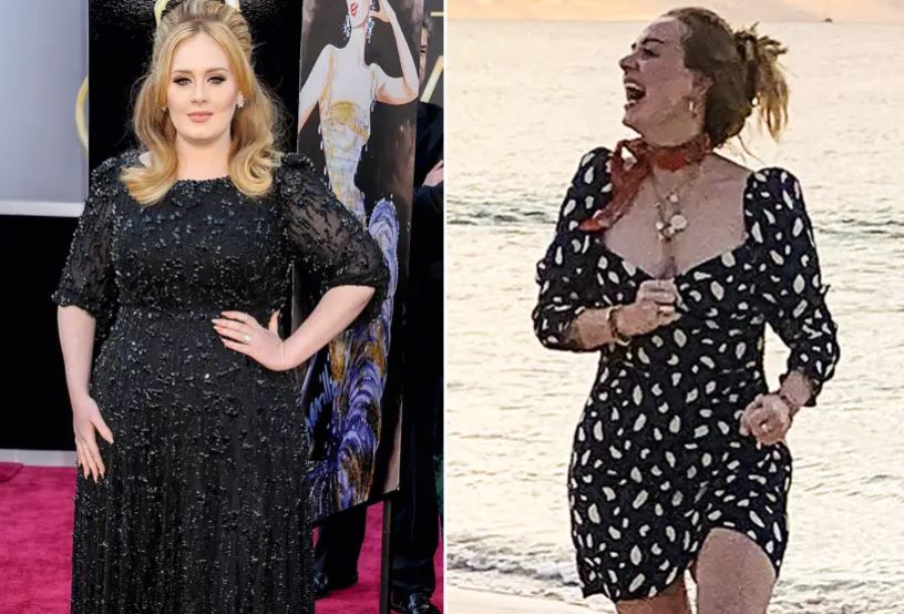 Adele Gastric Sleeve