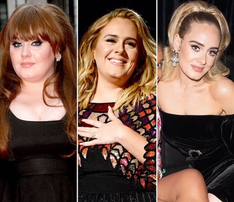 Adele Weight Loss Bariatric Surgery