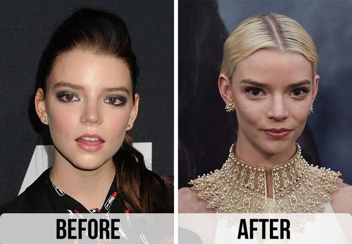 Anya Taylor Joy Weight Loss
